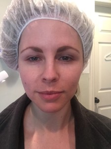 HYDRA FACIAL REVIEW: IS IT WORTH IT? by Nashville beauty blogger Nashville Wifestyles | Hydra facial is the latest craze in beauty & skin care to achieve results fast. My friend reached out to me and told me I had to try it. She raved about how much better her skin looked. Quite the splurge at $185, I searched for locations who did it in Nashville. An esthetician at Dr. Sieveking’s office downtown Nashville contacted me about trying it. She let me know I might be a little flushed for 30 minutes right after. Click to find out if it was worth it!