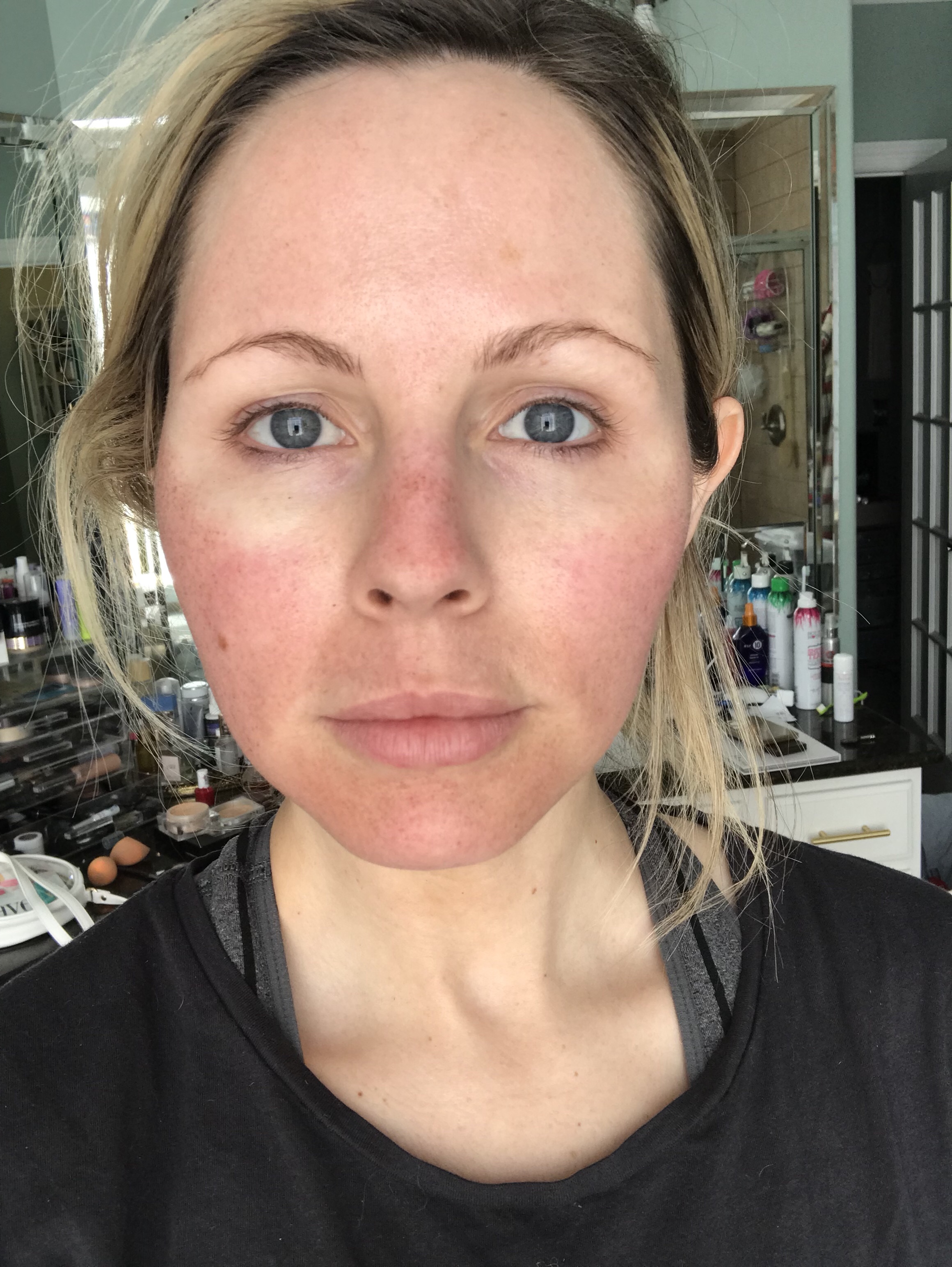 HALO LASER experience by popular Nashville beauty blogger, Nashville Wifestyles | I am 34 years old and have never had a laser until this year. It’s time, the sun has had its way with me and now I have to do whatever I can to reduce the damage. I've been intrigued by lasers for a while. After a few friends tried them, I decided to jump in. I am all for having nothing done and aging with grace. Click to read about how I am invested in taking care of my skin and my halo laser experience. We'll also discuss if the price is worth it. #laser #skincare