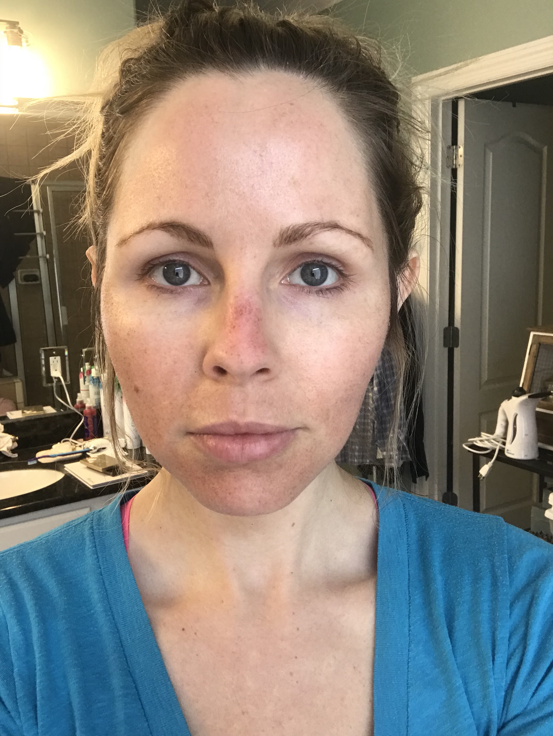 HALO LASER experience by popular Nashville beauty blogger, Nashville Wifestyles | I am 34 years old and have never had a laser until this year. It’s time, the sun has had its way with me and now I have to do whatever I can to reduce the damage. I've been intrigued by lasers for a while. After a few friends tried them, I decided to jump in. I am all for having nothing done and aging with grace. Click to read about how I am invested in taking care of my skin and my halo laser experience. We'll also discuss if the price is worth it. #laser #skincare