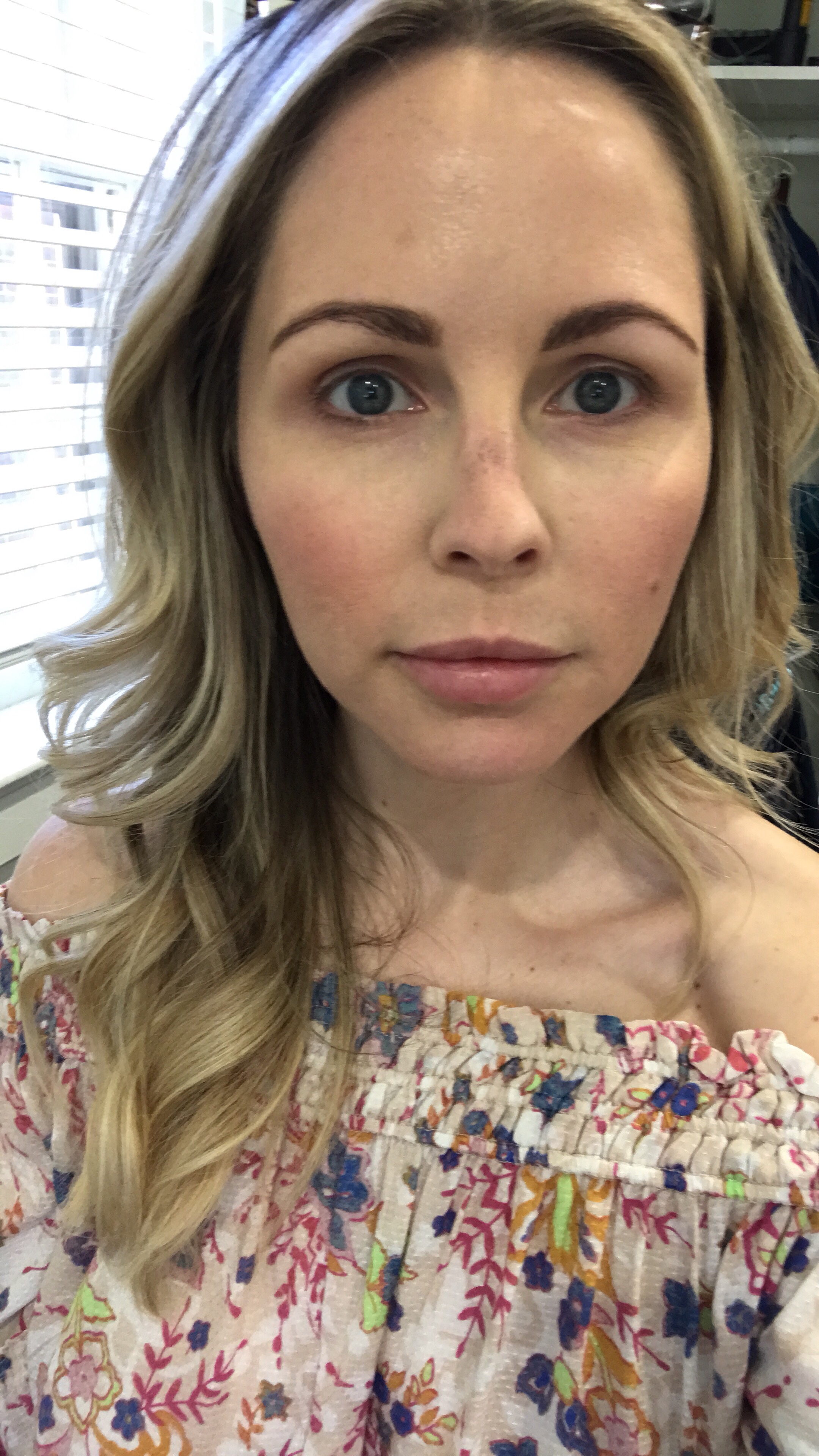 HALO LASER experience by popular Nashville beauty blogger, Nashville Wifestyles | I am 34 years old and have never had a laser until this year. It’s time, the sun has had its way with me and now I have to do whatever I can to reduce the damage. I've been intrigued by lasers for a while. After a few friends tried them, I decided to jump in. I am all for having nothing done and aging with grace. Click to read about how I am invested in taking care of my skin and my halo laser experience. We'll also discuss if the price is worth it. #laser #skincare