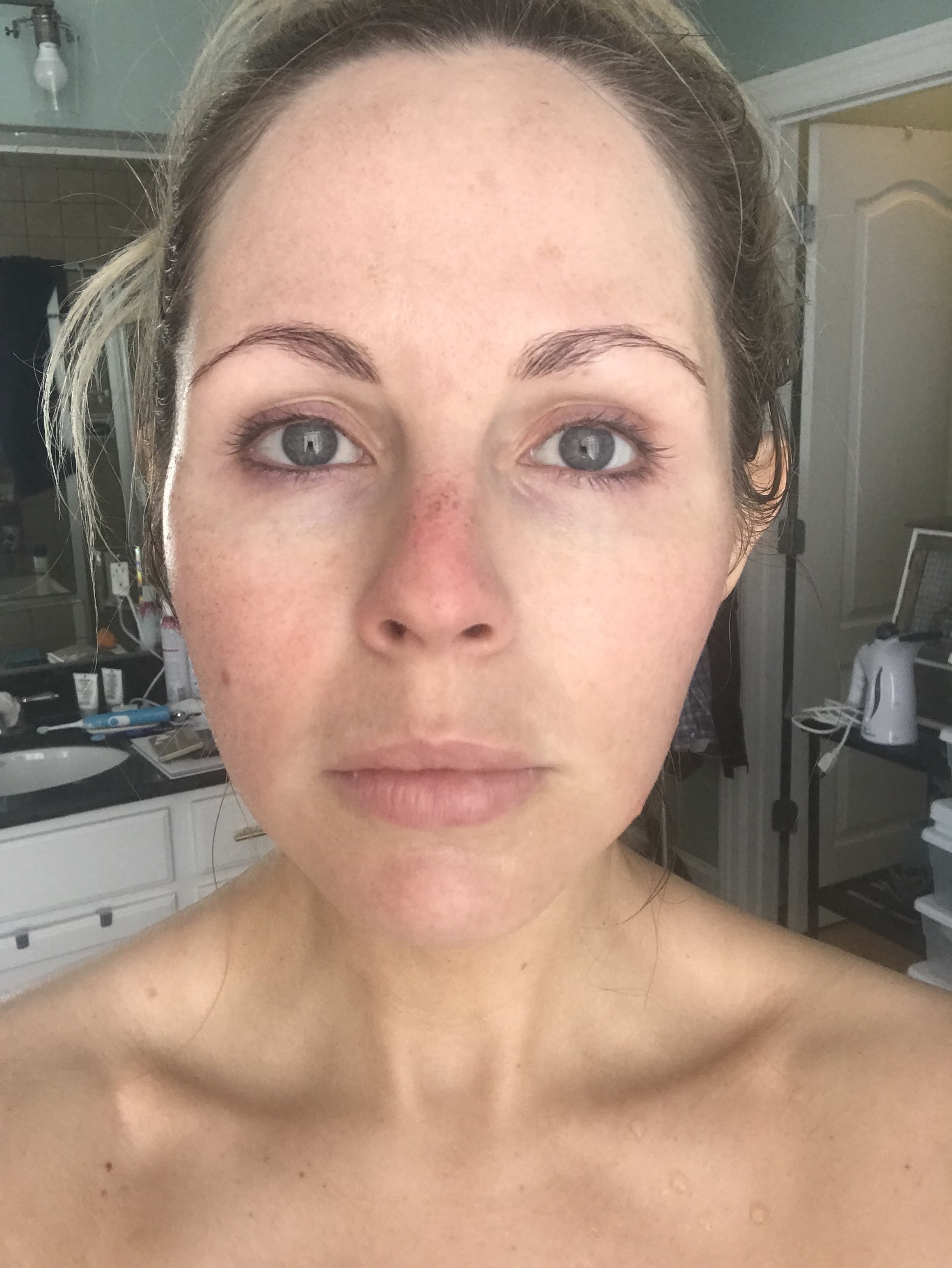 HALO LASER experience by popular Nashville beauty blogger, Nashville Wifestyles | I am 34 years old and have never had a laser until this year. It’s time, the sun has had its way with me and now I have to do whatever I can to reduce the damage. I've been intrigued by lasers for a while. After a few friends tried them, I decided to jump in. I am all for having nothing done and aging with grace. Click to read about how I am invested in taking care of my skin and my halo laser experience. We'll also discuss if the price is worth it. #laser #skincare